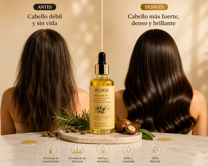 Aceite Esencial de Romero para el Crecimiento del Cabello - SUCCSION